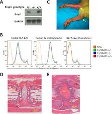 Find out when your third economic impact payment is scheduled to be sent, or when and how we sent it with the get my payment application. The Human Leukocyte Antigen Hla B27 Peptidome In Vivo In Spondyloarthritis Susceptible Hla B27 Transgenic Rats And The Effect Of Erap1 Deletion Molecular Cellular Proteomics