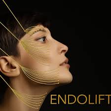 Lip Fillers Hertfordshire