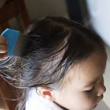 Look through the hair of any other adults or children in your household for active lice or small, dark eggs (also known as nits). Head Lice 101 What Lice Look Like How They Behave And How Kids Get Them Babycenter