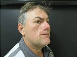 Fritz Jacobs's Instagram, Twitter & Facebook