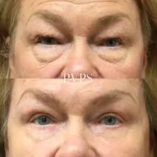 EYE can't get enough of this...