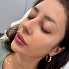 Lips, chin, and jaw combo 😍 with enhancing the chin and jaw, the face  definitely looks more proportioned. The changes are subtle but so  beautiful. We like to enhance your features, not