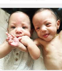 Day 767 💗 Meet Diana 🥰 Remember this story when someone says a baby is  “too small to be intubated.” Diana was born weighing only ❗️12 OUNCES❗️  Yes, you read that right.