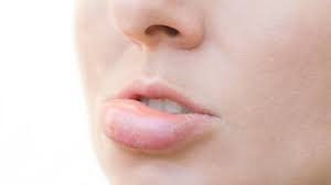 We did not find results for: Tiba Tiba Bibir Bengkak Saat Bangun Tidur Ini Penyebab Dan Mengatasinya