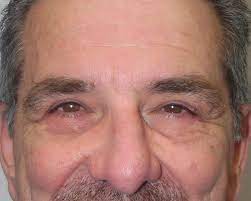 805 w 5th ave ste 619 spokane, wa 99224 get directions edit business info about the business at stiller aesthetics, our goal is to help you become the you, you want to be. Stiller Aesthetics
