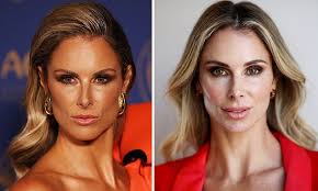 Candice Warner makes a shock Botox confession as she reveals the bizarre  place she gets it