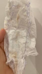 5ssw Blutung Oder Ausfluss Achtung Bild Forum Schwangerschaft Urbia De