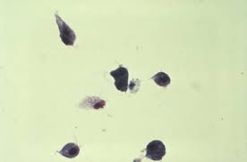 Würmer sind parasiten und können bei menschen erheblichen schaden anrichten und wurminfektionen verursachen. Einzelliger Parasit Mit Mehr Genen Als Mensch