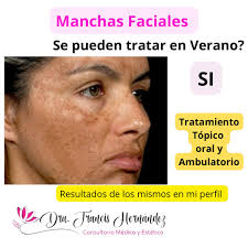 Dra.Francis Hernandez