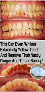 Pin On What Is Oral Care System