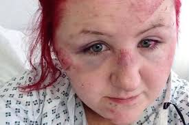 Teenager left with FOOTPRINT