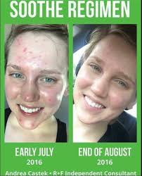 What are some good skincare routines for welding and fabrication students?