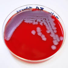 Image result for Anthrax