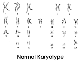 Das iliosakralgelenk verbindet die wirbelsäule mit dem becken. Androgen Insensitivity Syndrome Medlineplus Genetics