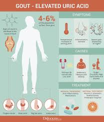 Gout Symptoms Causes And Natural Support Strategies Gout Remedies Gout How To Cure Gout