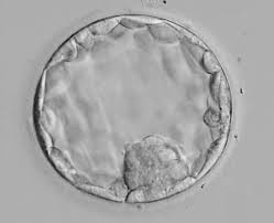 embryo grading how do you choose an embryo for ivf