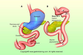Pin On Surgery