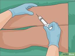 Where they are small, the injections are done directly on the skin surrounding the scar. 4 Ways To Remove Scars On Legs Wikihow