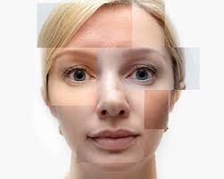 One or three ipl photofacials at dfw laser aesthetics (up to 67% off) and also view dfw laser aesthetics in dallas. Dfw Laser Aesthetics Dfw Laser Aesthetics Offers The Latest In Skin Care Technology In The Dallas Fort Worth Surrounding Areas