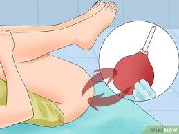 Auf dem weg dorthin gilt: Zuhause Einen Einlauf Setzen Wikihow