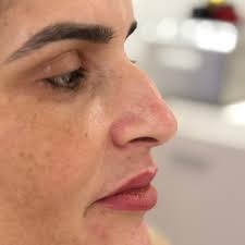 Eva Medeiros Massoterapeuta.