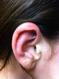 Double Rook Rook