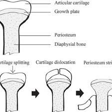 Editor · aug 13, 2017 ·. Section Of Long Bone From Broiler Chicken Showing Bone Structure A Download Scientific Diagram