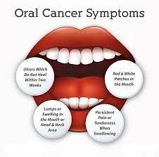 Image result for cancer of tongue