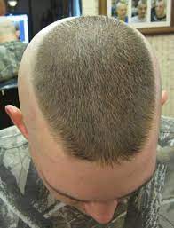 Mohawk Haircut Army Perubatan S