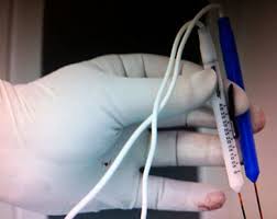 اكتشاف نشوء سرطان الغدد اللمفاوية تشيكيا أخبار الجزيرة نت