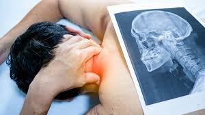 Durere de cap, ameteli si greata sau varsaturi. Spondiloza Cervicala Simptome Tratament Si Exercitii Dr Max Dr Max