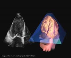 Krankengeschichte (anamnese) und symptome ; Ultraschall Und Stressechokardiographie In Der Kardiologie Praxis Westen Berlin
