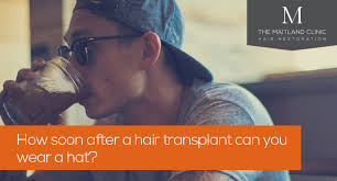 This isn't essential but it may make things easier for you and if you're admitted for more than 3 days and unable to shampoo within those 3 days, a scrunching will save you. Can You Wear A Hat After A Hair Transplant How Long The Op