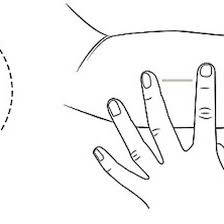 deri alti implantlari ile gebelikte korunma gebe com