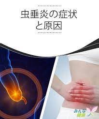 虫垂炎の症状と原因 みんな健康 症状 痛み 健康