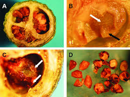 Image result for Syzygium komatiense