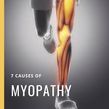 Image result for Myopathy