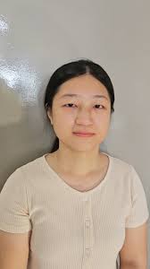 我真的太多单眼皮顾客了 , 眼睛调整后真的好漂亮呀