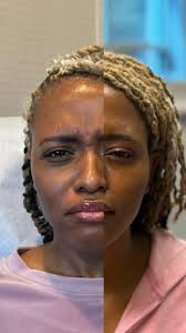 Lauren Padmore, Aesthetic Nurse Injector