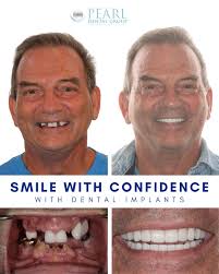 I was nervous about implants, so I booked a free consult with a  board‑certified specialist through SmilePaths. They reviewed my options,  shared transparent pricing, and explained an affordable payment plan. I  chose