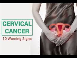 The first sign may be minor, but the second could be major discomforts. 10 Warning Signs And Symptoms Of Cervical Cancer Self Care Youtube