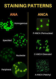 Image result for ANA Staining Pattern