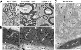 Jun 10, 2019 · it the nerve was traumatized or bruised, then recovery rate is around 6 to 12 weeks. Myelin Sheath Structure And Regeneration In Peripheral Nerve Injury Repair Pnas