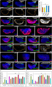 Focus stacking is a unique technique that lets us get a seemingly impossible depth of field. Modulation Of Occluding Junctions Alters The Hematopoietic Niche To Trigger Immune Activation Elife
