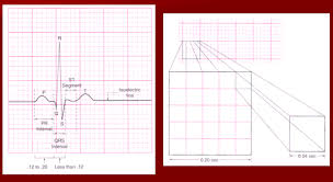 Components Of Ecg And Ecg Grid Teaching Resources