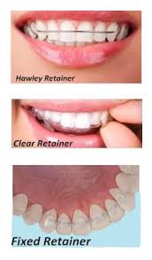 What Type Of Retainer Is Best Teeth Braces Teeth After Braces Retainer Teeth