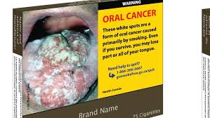 Newport beach marriott hotel & spa, newport beach. Cigarette Packages Will Be The Ugliest Colour In The World Starting In November Cbc News