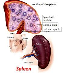 Image result for Splenomegaly