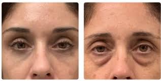 Dr Hessler is Amazing!