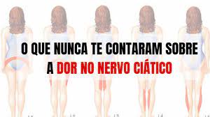 Nervo Ciatico Causa Emocional Matheus Colombo Youtube